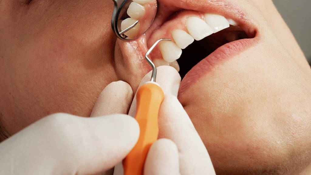 tandarts-scaled