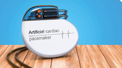 De pacemaker: van externe kast tot thuismonitoring van je ICD