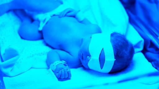 Fototherapie voor baby's in thuissituatie krijgt schaalgrootte