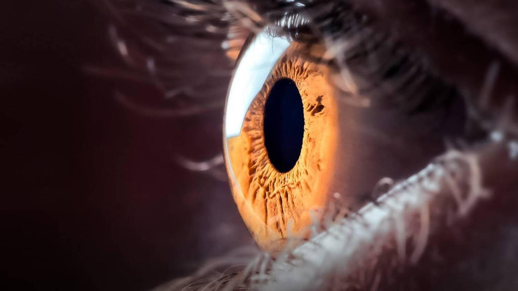 diabetische-retinopathie-oog