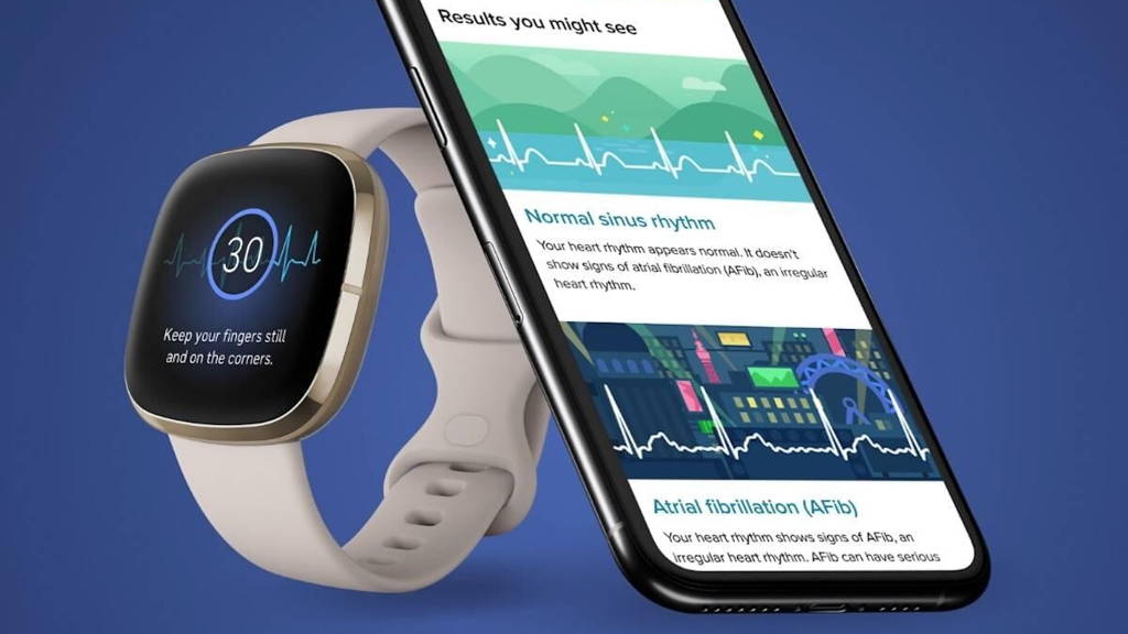 Fitbit-ECG-App