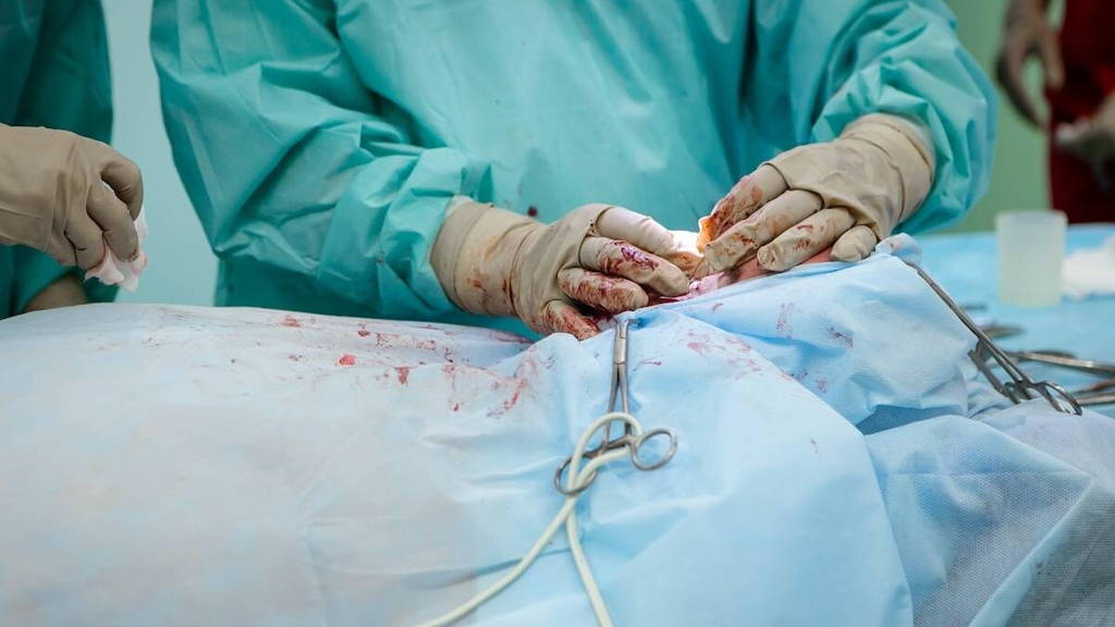 Chirurgie-Transplant