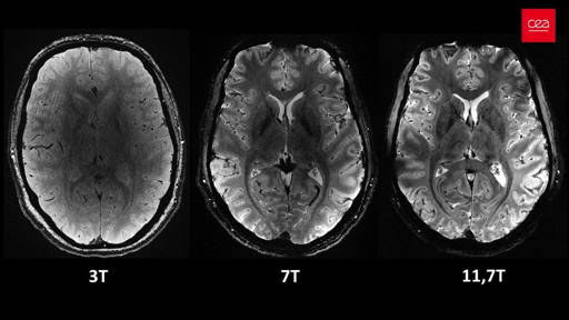 Grootst MRI-Scanner ooit toont hersenen in  hogere resolutie