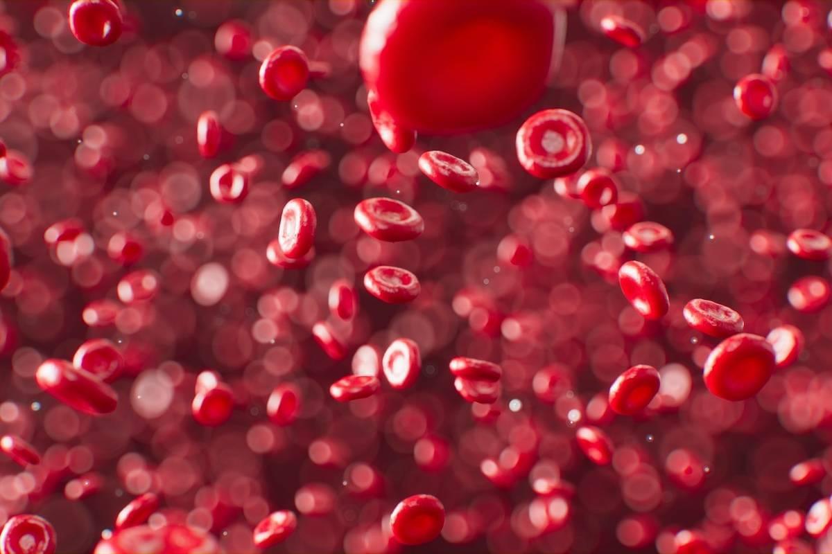 Algoritme kan bloedarmoede door ijzertekort opsporen - ICT&health | Het