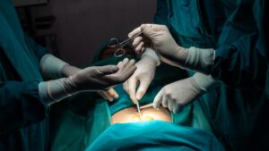 AI onderwijsinstructie chirurgie training